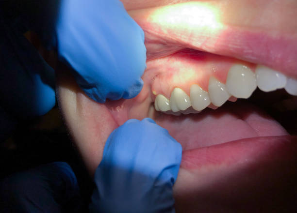 Best Walk-In Emergency Dentist in Webster Groves, MO