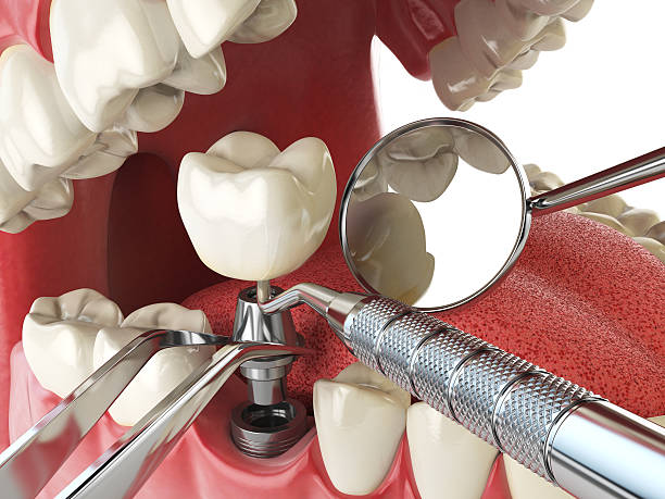 Best Walk-In Emergency Dentist in Webster Groves, MO